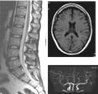 MRI（Magnetic Resonance Imaging）